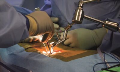 Spine Surgery