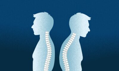 Osteoporosis