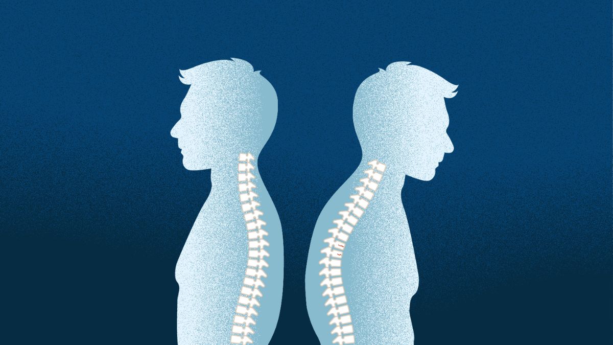 Osteoporosis