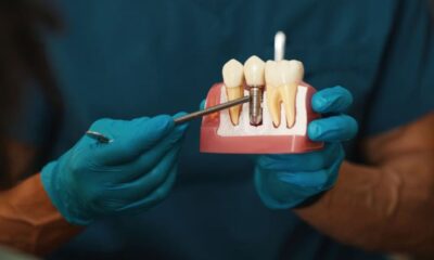Dental Implant
