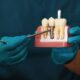 Dental Implant