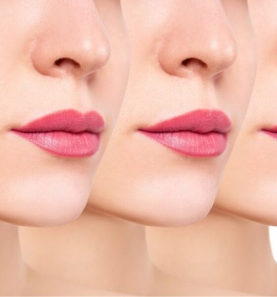 Lip Injections