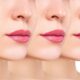 Lip Injections
