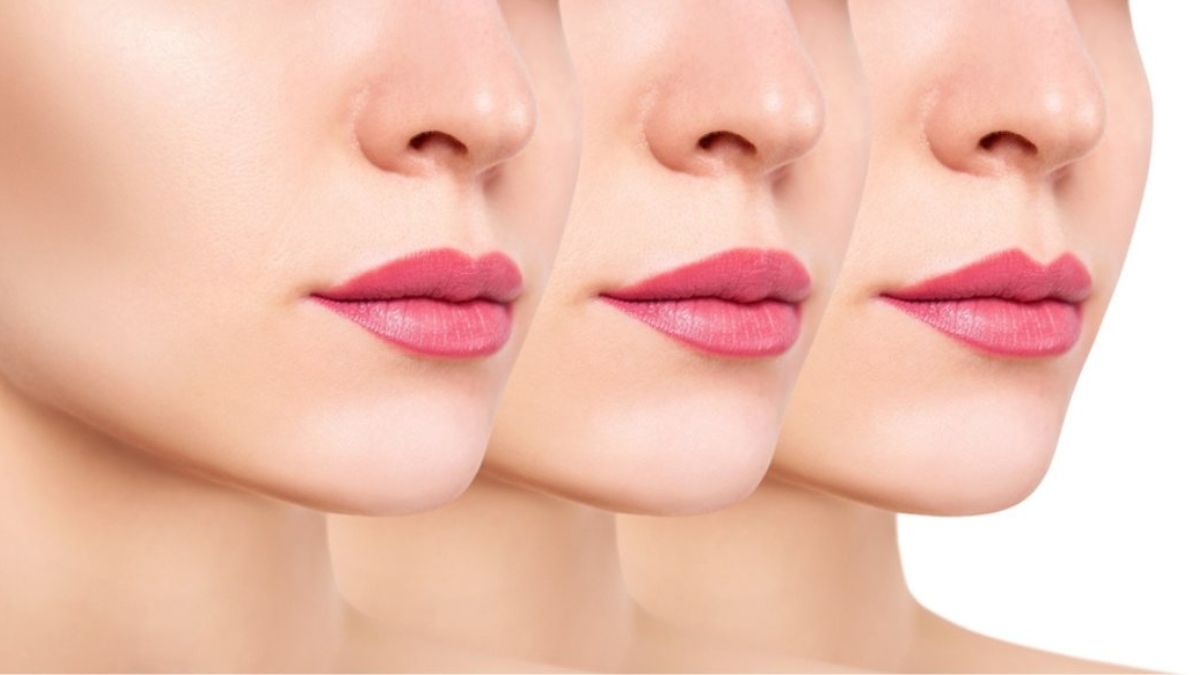 Lip Injections
