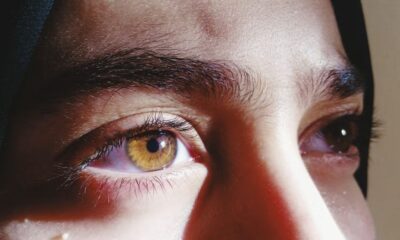 Vision