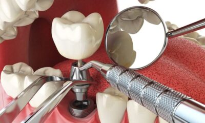 dental implant course