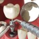 dental implant course