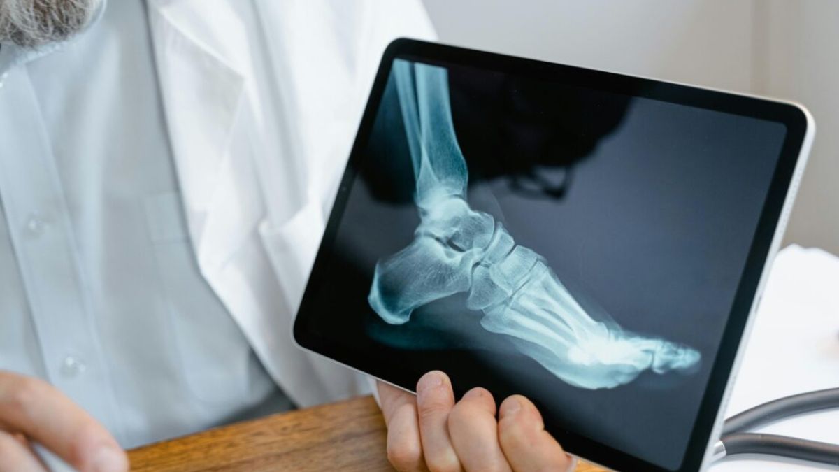 osteopur