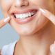 Home Whitening
